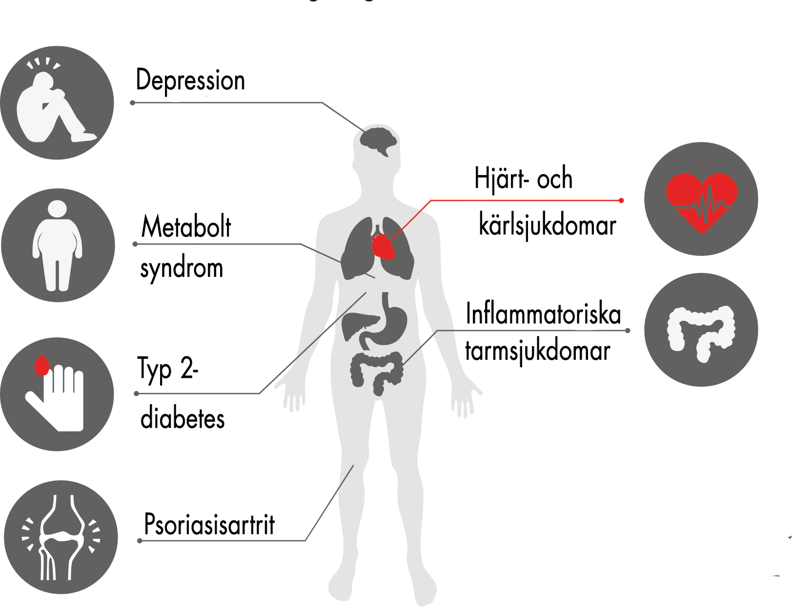 hjärtinfarkt symptom