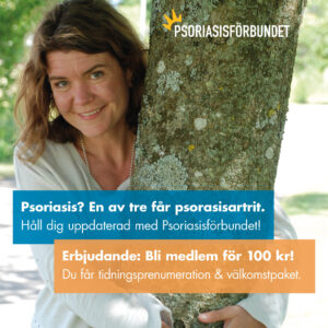 Sommar Annons 2025